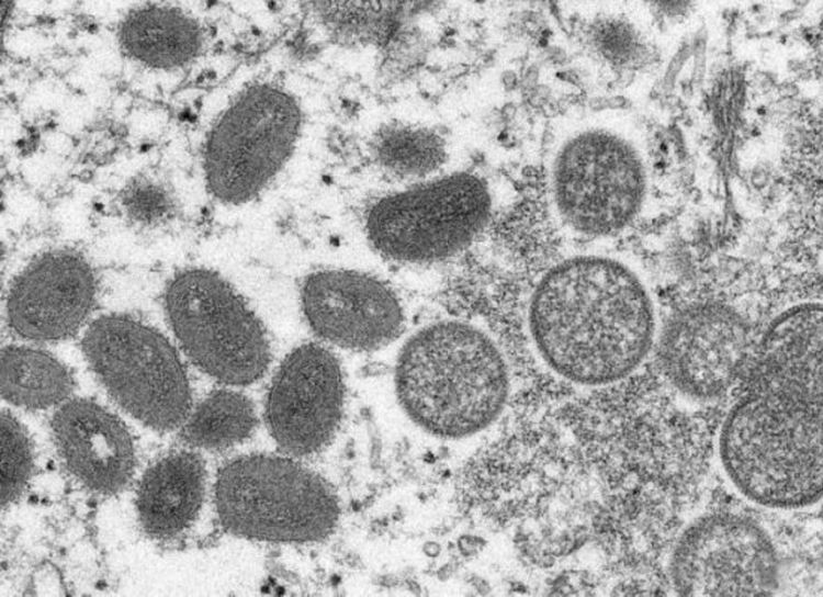 What Disease Is Monkeypox Reported in Many Countries?